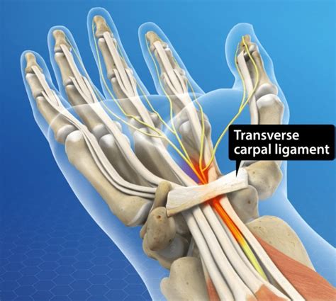 transverse carpal ligament - anterior annular ligament