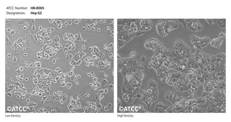 Cell culture conundrum II: HepG2 cells grow slowly and forms clumps extensively. How to reduce ...