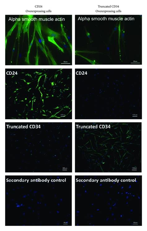 Expression of alpha smooth muscle actin. Intracellular... | Download ...