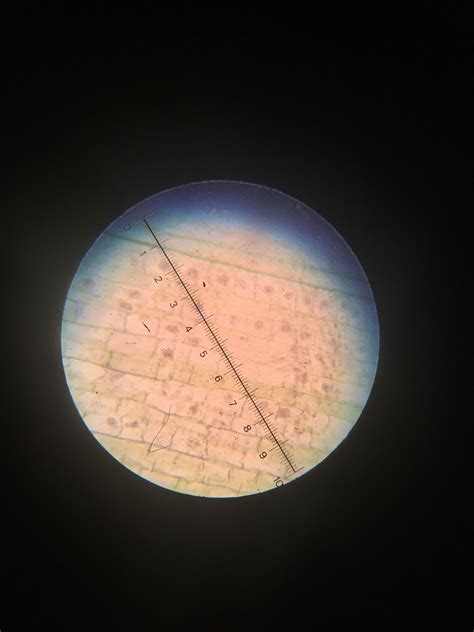 Root hair cells under a light microscope | Biology, A level biology, Celestial