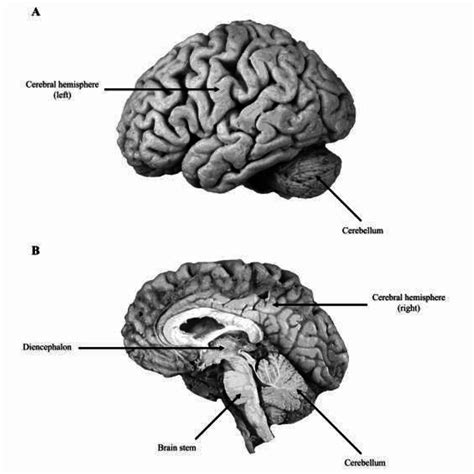 Gross anatomy of the human brain and its major constituent parts ...