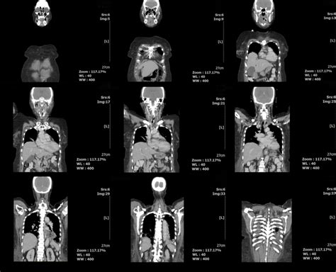 The experience after a CT exam | Two Views