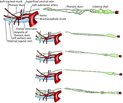 Minimally Invasive Chylothorax Treatment | Veterian Key