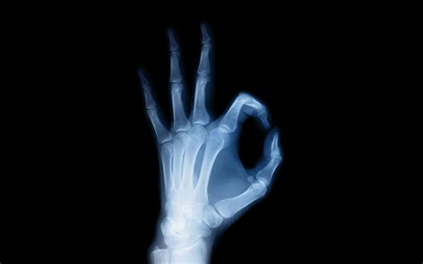 Download X-ray Vision Anatomy Hand Photography X-ray HD Wallpaper