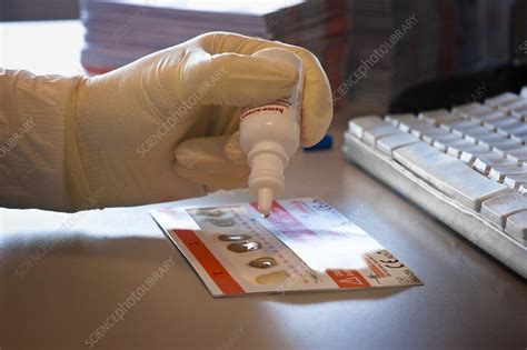 Faecal occult blood test for bowel cancer - Stock Image - C009/4923 - Science Photo Library