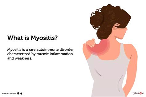 Myositis - Causes, Symptoms, Treatment