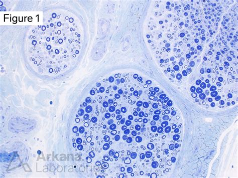 Toluidine Blue Stained Thick Section | Neuro Notes | Arkana Labs