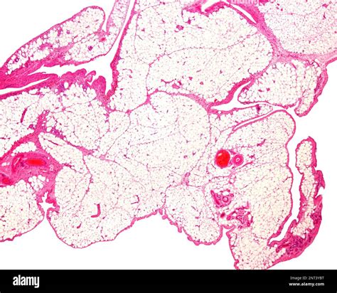 Very low magnification light microscope micrograph of white adipose ...