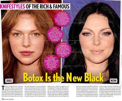 Botox is the New Black – Dr. Michelle Copeland, Plastic Surgeon, New ...