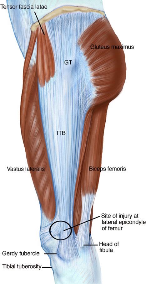 Epicondyle Mediale Femur : My Son Has A Swollen Knee Axis / The medial ...