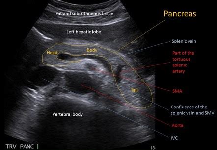 Abnormal Pancreas Ultrasound