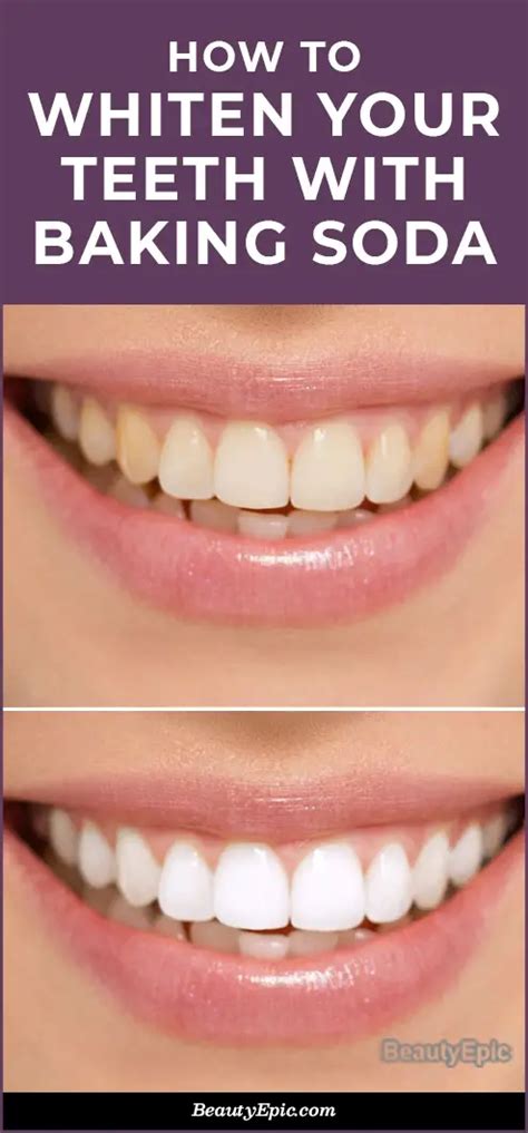 How To Whiten Your Teeth With Baking Soda - 7 Best Ways