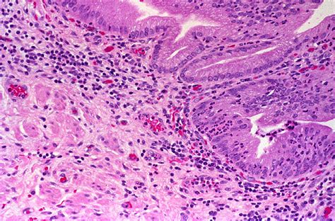 Gallbladder histology ppt