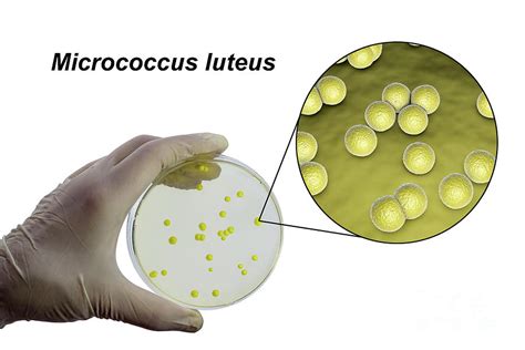 Micrococcus luteus antibiotic treatment