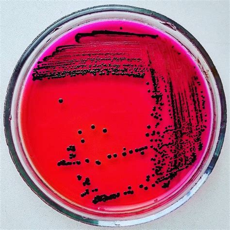 Salmonella On Xld Agar / The agar used for preparation of culture media must be microbiological ...