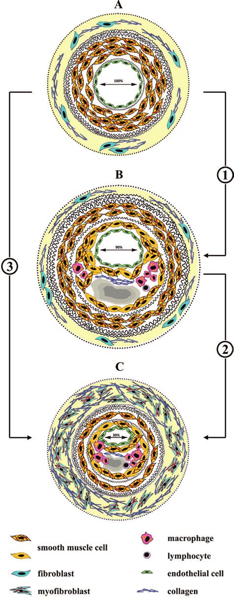 Figure. Role of adventitia in arterial remodeling. A, In the normal... | Download Scientific Diagram