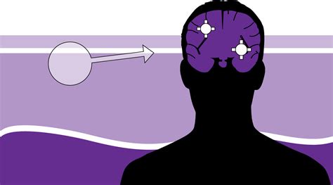 Brain Metastases - AIM at Melanoma Foundation