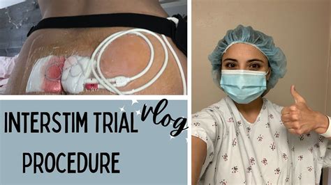 My Experience with the InterStim Trial Procedure 🌟 VLOG 🌟 Treatment for Bladder Dysfunction ...