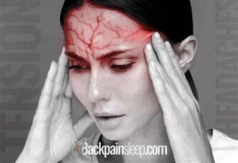 Tension Headaches Cause: 2 proven relief methods