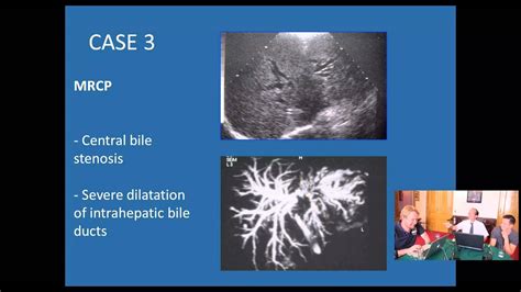 Webinar: Radiology: Sonography of the abdomen - YouTube