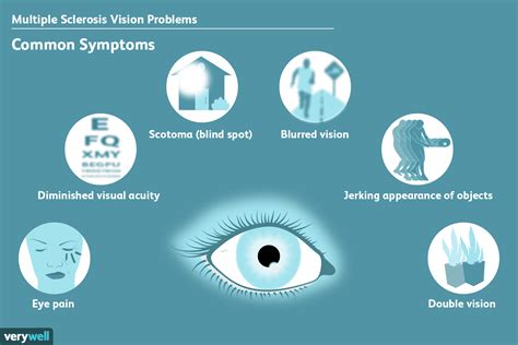 Vision Problems Caused By MS