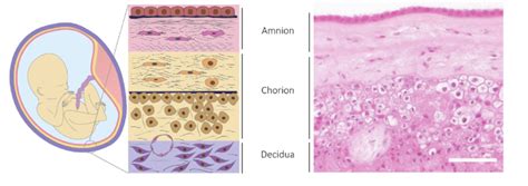 Structure of the fetal membranes. The fetal membranes are composed of... | Download Scientific ...