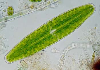 Brown Algae Under Microscope Labeled