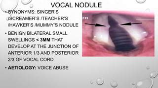 Benign lesions of larynx | PPT