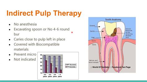 Indirect Pulp Capping in Primary Teeth, a Literature Review - YouTube