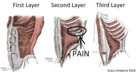 WHAT TO KNOW ABOUT ABDOMINAL STRAIN 2 - Muscle Pull | Muscle Pull