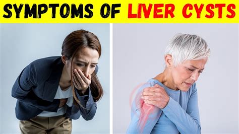 Symptoms of Liver Cysts and Pain Causes and Treatment - YouTube