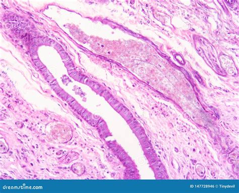 Histology of Epiglottis Human Tissue Stock Photo - Image of pathology, show: 147728946