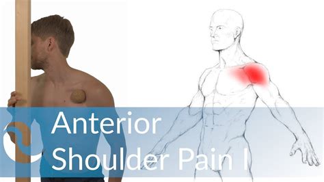 Diagram Of Shoulder Pain - Scalene - Physiopedia : Shoulder pain is a common problem, affecting ...