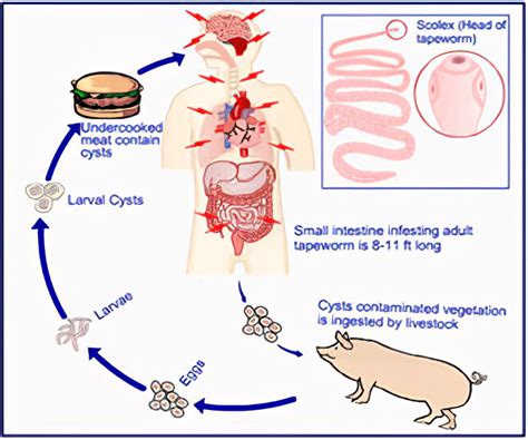 Can Tapeworm Be Passed From Dog To Human