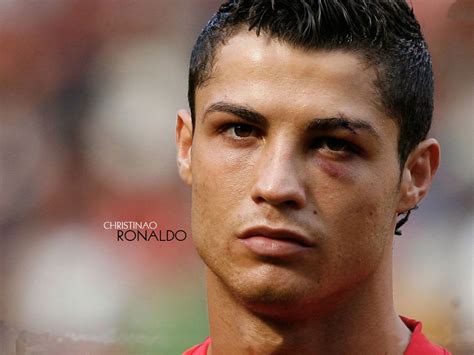 I guess he had that eye injury sometime ago... | Ronaldo, Cristiano ronaldo, Christiano ronaldo