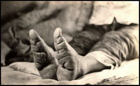 Rare Photographs of Chinese Foot Binding from the 1800s - Vision Times ...