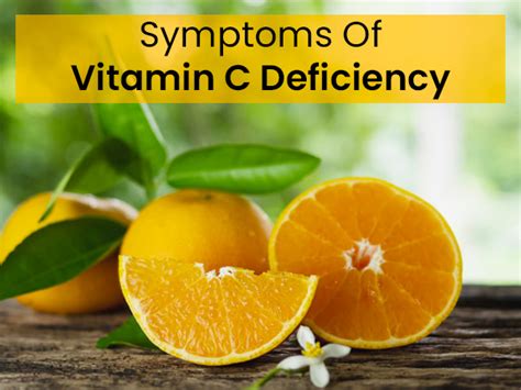 12 Early Symptoms Of Vitamin C Deficiency - Boldsky.com