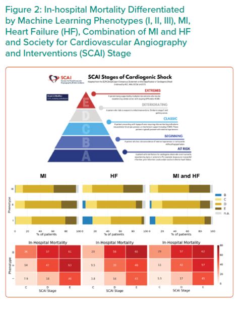 Identification of Three Phenotypes of Cardiogenic Shock | ICR Journal