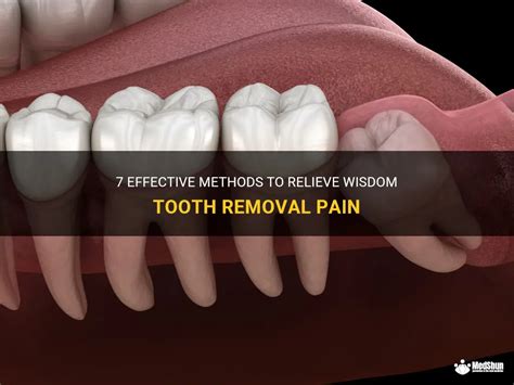 7 Effective Methods To Relieve Wisdom Tooth Removal Pain | MedShun
