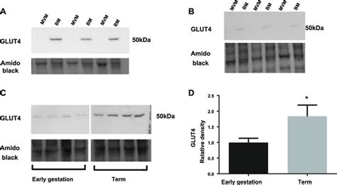 GLUT4 protein is exclusively expressed in the syncytiotrophoblast BM.... | Download Scientific ...