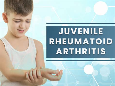 Juvenile Rheumatoid (Idiopathic) Arthritis: Causes, Symptoms, Diagnosis ...