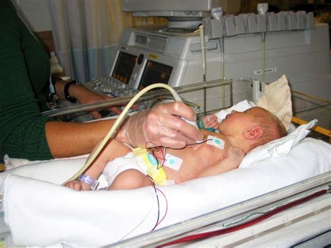 Taylor's Journey: Neonatal ICU