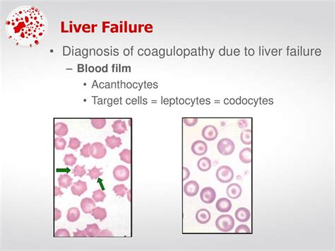 Practical Clinical Pathology Diagnosing Coagulopathy - ppt download