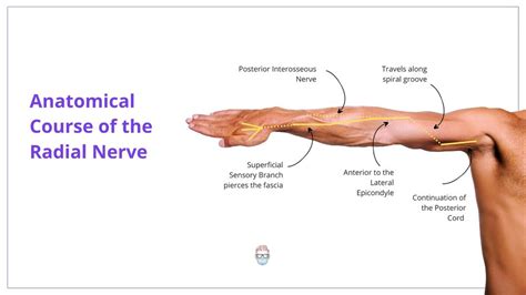 Radial Nerve Palsy