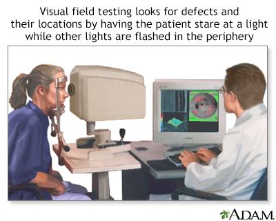 Optic nerve atrophy Information | Mount Sinai - New York