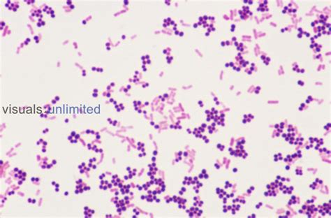 staphylococcus aureus gram stain