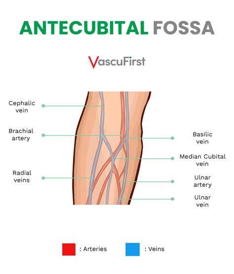 Short Peripheral Intravenous Catheters (SPIVC) vs Extended Dwell Catheters (EDC) - VascuFirst