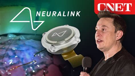 Elon Musk’s Neuralink Event: Everything Revealed in 10 Minutes | Elon ...