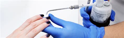 Explaining Cryosurgery and Why Is It Performed?