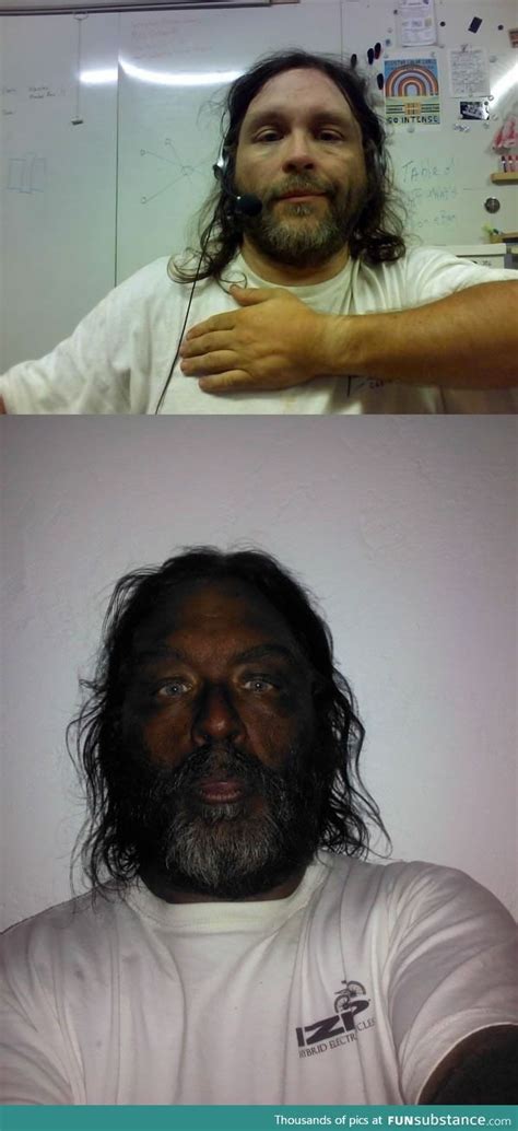 Before and after photos of a man injecting himself with Melanotan II - FunSubstance